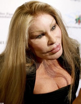 Jocelyn-Wildenstein.jpg