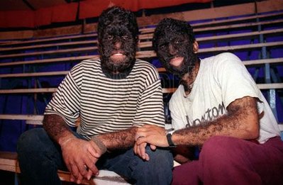 wolf-boys-people-mexican-international-circus-disease-hair-hairy-abstract_14749.jpg