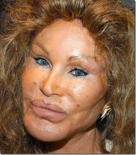 Lion-Lady-Plastic-Surgery.jpg